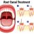 Group logo of Seven Myths Regarding Root Canal Therapy!